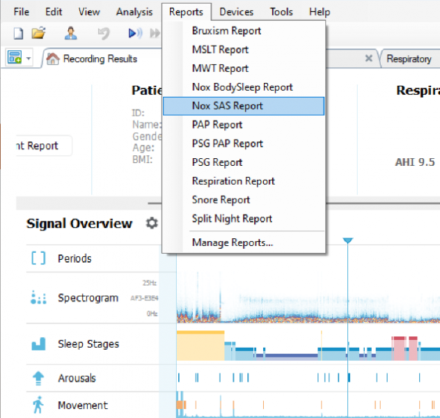 sas_reports.png sas_reports.png