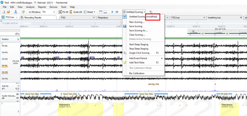scoring.png scoring.png