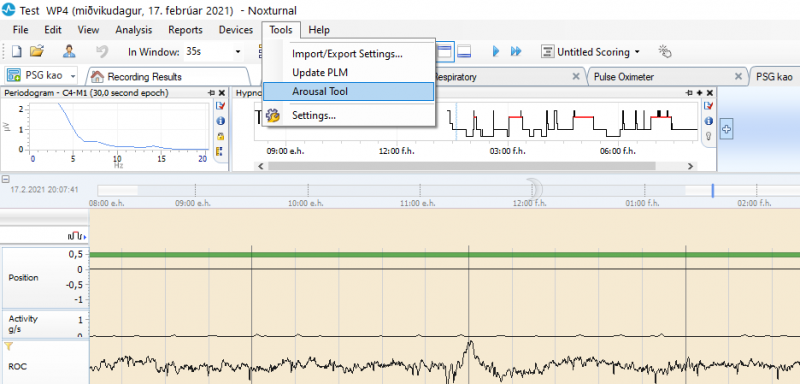 arousal_tool.png arousal_tool.png