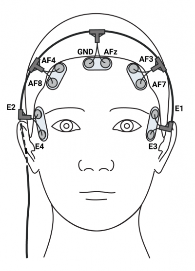 Polysomnography - Wikipedia